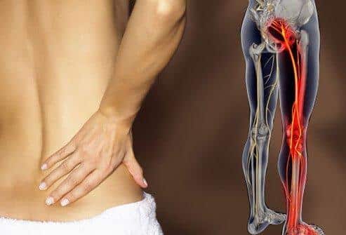 Massage can alleviate sciatic pain - Home Comfort Therapy